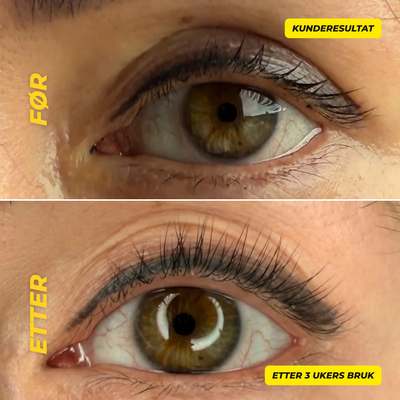 Grow Gasm Lash Serum